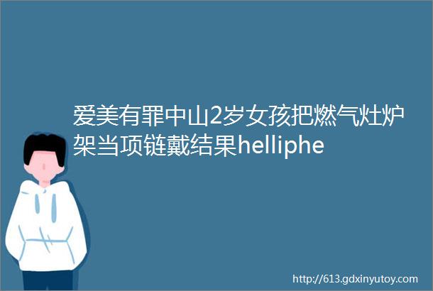 爱美有罪中山2岁女孩把燃气灶炉架当项链戴结果helliphellip